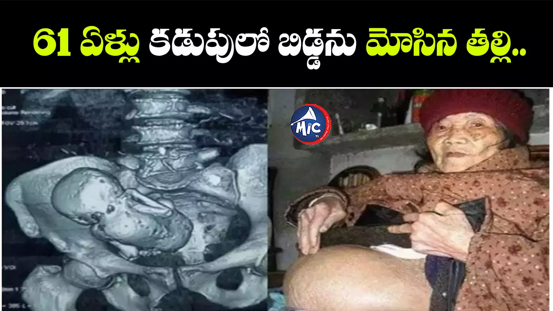 Viral News : 61 ఏళ్లు కడుపులో బిడ్డను మోసిన తల్లి.. పేదరికంతో ఎంత కష్టం!