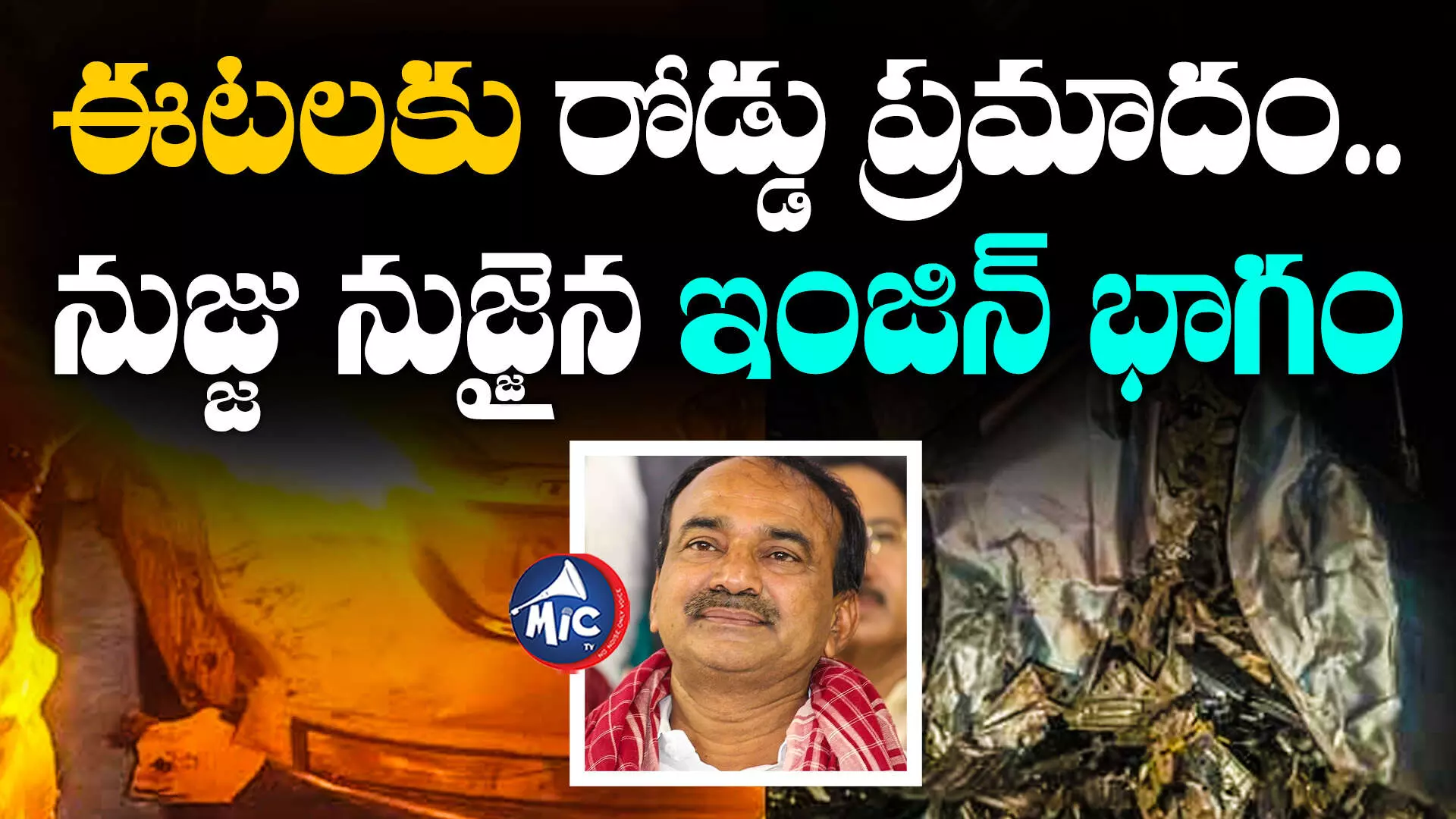 Etela Rajender : ఈటలకు రోడ్డు ప్రమాదం.. నుజ్జు నుజ్జైన ఇంజిన్ భాగం