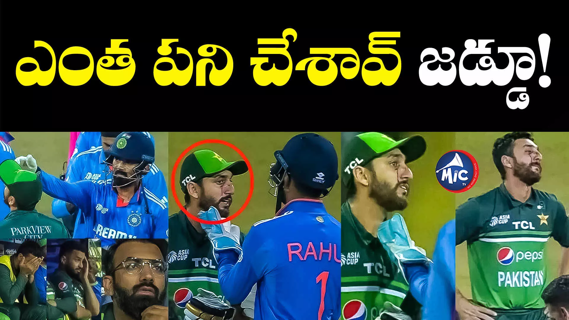 IND vs PAK: జడేజా బంతికి.. ముఖం పగిలింది. తర్వాత మ్యాచ్⁬కు డౌటే?