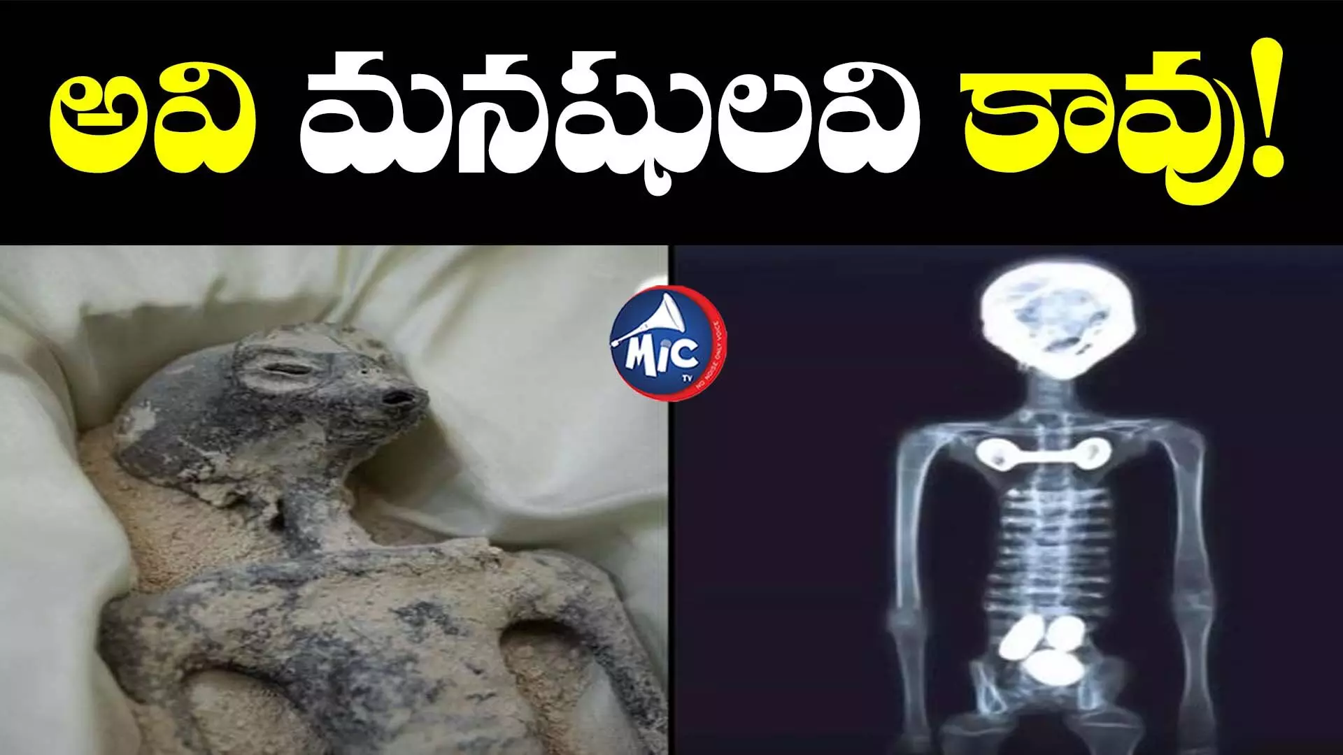 ‘ఏలియన్ల’కు స్కానింగ్ పూర్తి... ఫలితాల్లో సంచలన విషయాలు...