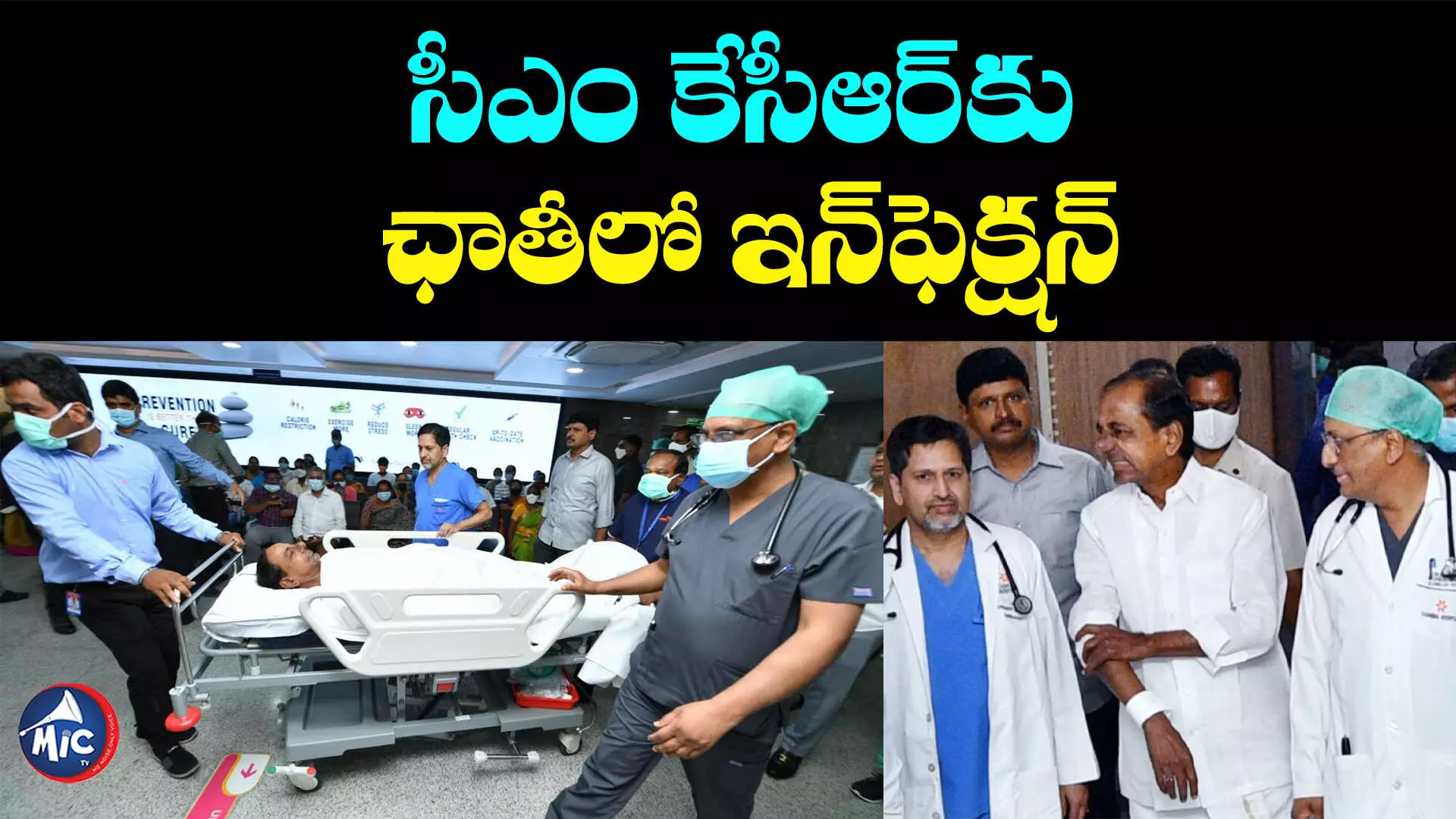 CM KCR HEALTH: సీఎం కేసీఆర్‌కు ఛాతీలో ఇన్‌ఫెక్షన్‌