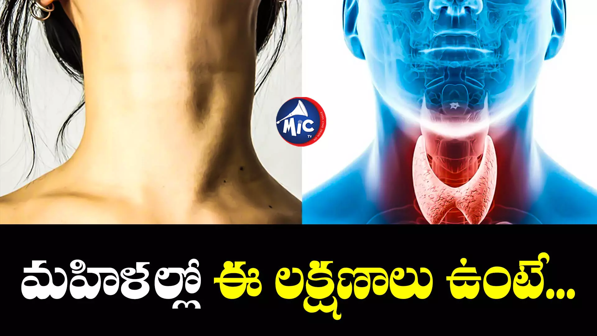 Thyroid Disease : ఉన్నట్లుండి బరువు పెరిగారా? అయితే ఈ వ్యాధి కన్ఫామ్