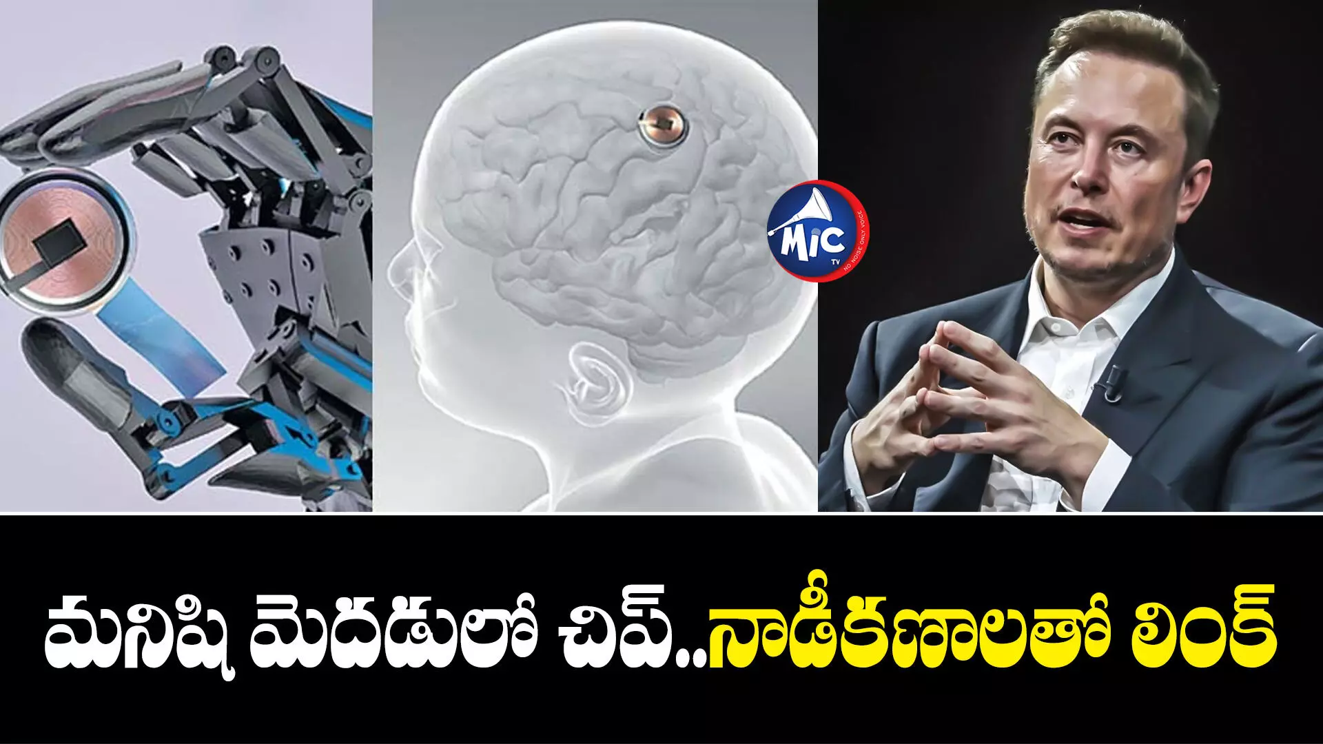 Elon Musk  : తొలిసారి మెదడులో చిప్.. షాకింగ్ విషయం చెప్పిన ఎలోన్ మస్క్