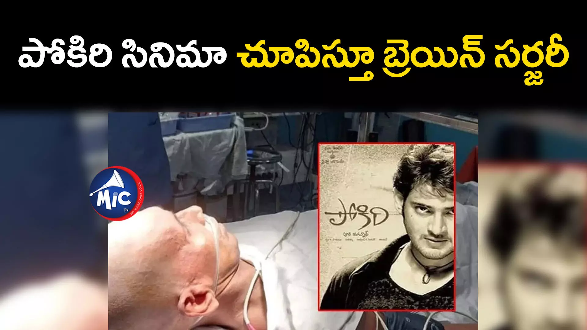 Guntur doctors : సినిమా థియేటర్⁬గా మారిన హాస్పిటల్.. పోకిరి సినిమా చూపిస్తూ బ్రెయిన్ సర్జరీ