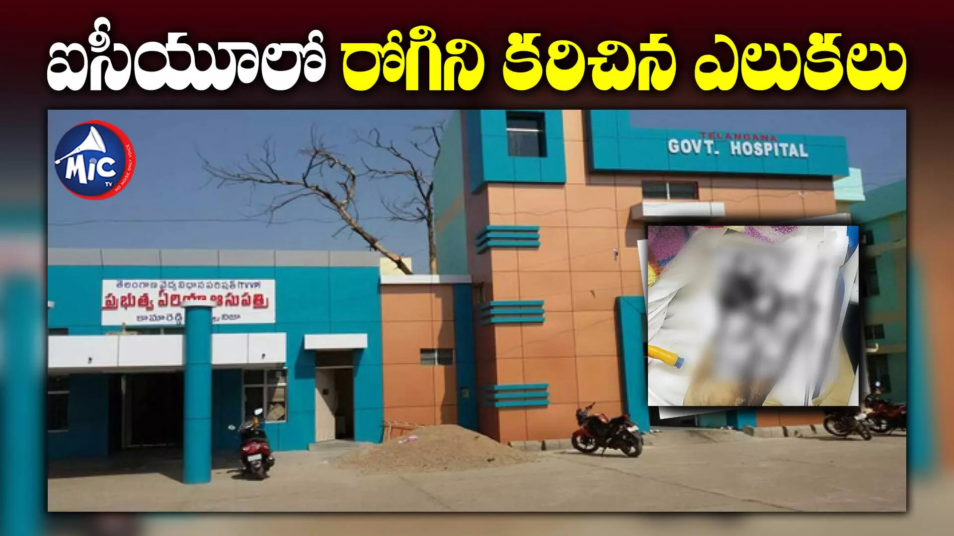 Kamareddy Govt Hospital : ఐసీయూలో రోగిని కరిచిన ఎలుకలు.. కామారెడ్డి ప్రభుత్వాసుపత్రిలో దారుణం